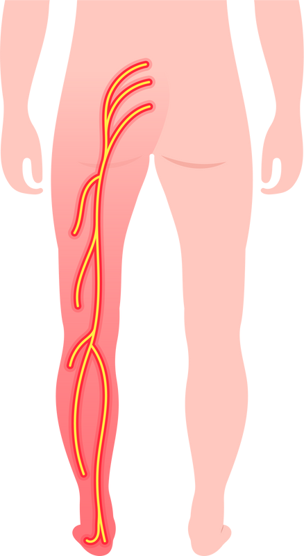 spinal bone disk nerve broken curves poor hunched over back dowager’s  pain injury spine density test lumbar disc Piriformis syndrome pinched radiculopathy sacroiliac joint sacroiliitis